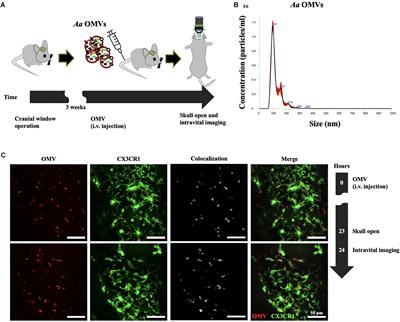 Delivery of Periodontopathogenic Extracellular Vesicles to Brain Monocytes and Microglial IL-6 Promotion by RNA Cargo